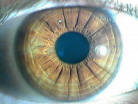 radials a  brown  iris